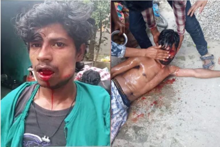 When We Helped Three Dalit Brothers Assaulted By A Mob With Medical Expenses And A Food Business